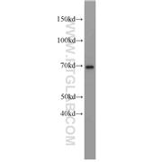 HSD11B1 Rabbit Polyclonal Antibody (10928-1-AP)
