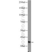 GLYAT Rabbit Polyclonal Antibody (10900-1-AP)