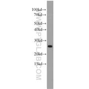 RAD51L3 Rabbit Polyclonal Antibody (11126-1-AP)