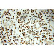 SNRPN Rabbit Polyclonal Antibody (11070-1-AP)