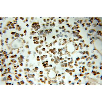 SNRPN Rabbit Polyclonal Antibody (11070-1-AP)