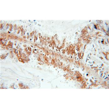 SYCE1 Rabbit Polyclonal Antibody (11063-1-AP)