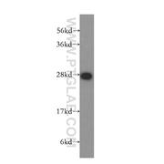PTGDS Rabbit Polyclonal Antibody (10754-2-AP)
