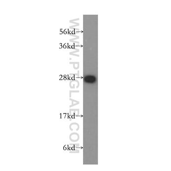 PTGDS Rabbit Polyclonal Antibody (10754-2-AP)