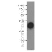 ARR3 Rabbit Polyclonal Antibody (11100-2-AP)