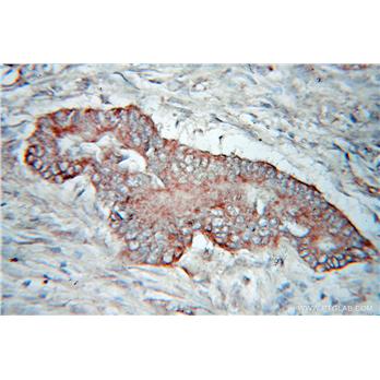 PDHX Rabbit Polyclonal Antibody (10951-1-AP)