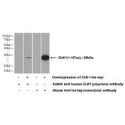 GUK1 Rabbit Polyclonal Antibody (10755-1-AP)