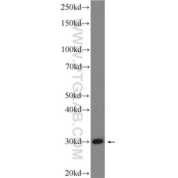 PTGES2 Rabbit Polyclonal Antibody (10881-1-AP)