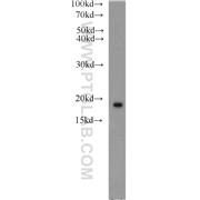 NME1 Rabbit Polyclonal Antibody (11086-2-AP)