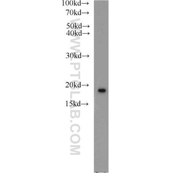 NME1 Rabbit Polyclonal Antibody (11086-2-AP)