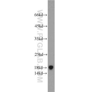 TCEB2 Rabbit Polyclonal Antibody (10779-1-AP)