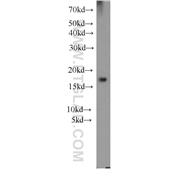 CFL1 Rabbit Polyclonal Antibody (10960-1-AP)