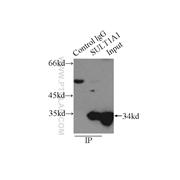 SULT1A1 Rabbit Polyclonal Antibody (10911-2-AP)