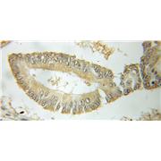 YWHAB Rabbit Polyclonal Antibody (10936-1-AP)