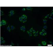 RDH11 Rabbit Polyclonal Antibody (11077-1-AP)