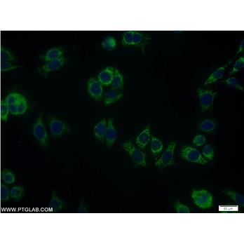 RDH11 Rabbit Polyclonal Antibody (11077-1-AP)