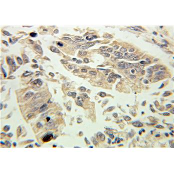 KLK1 Rabbit Polyclonal Antibody (10815-1-AP)