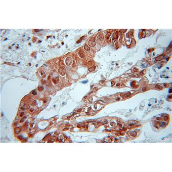 RIC8A Rabbit Polyclonal Antibody (11138-1-AP)