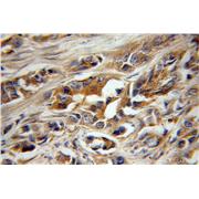 LAT2 Rabbit Polyclonal Antibody (11008-1-AP)