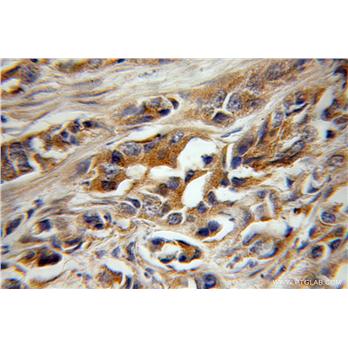 LAT2 Rabbit Polyclonal Antibody (11008-1-AP)