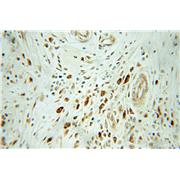 RGS2 Rabbit Polyclonal Antibody (10678-1-AP)