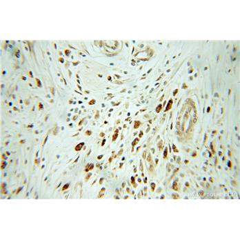 RGS2 Rabbit Polyclonal Antibody (10678-1-AP)