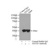 EEF1D Rabbit Polyclonal Antibody (10630-1-AP)