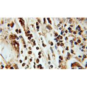 ING3 Rabbit Polyclonal Antibody (10905-1-AP)