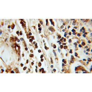 ING3 Rabbit Polyclonal Antibody (10905-1-AP)