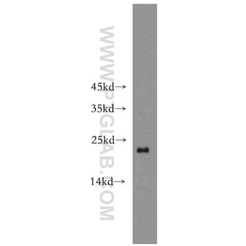 ARF1 Rabbit Polyclonal Antibody (10790-1-AP)