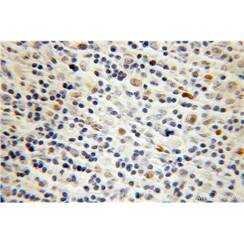 POU2F2 Rabbit Polyclonal Antibody (10867-2-AP)