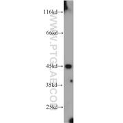 ITPK1 Rabbit Polyclonal Antibody (10568-1-AP)