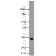 UCP2 Rabbit Polyclonal Antibody (11081-1-AP)
