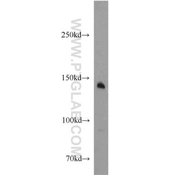 MST1R Rabbit Polyclonal Antibody (11053-1-AP)