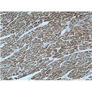 ATP5O Rabbit Polyclonal Antibody (10994-1-AP)