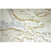 OPTN Rabbit Polyclonal Antibody (10837-1-AP)