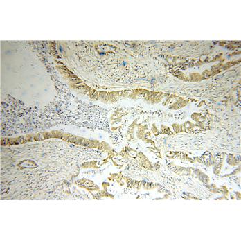 OPTN Rabbit Polyclonal Antibody (10837-1-AP)