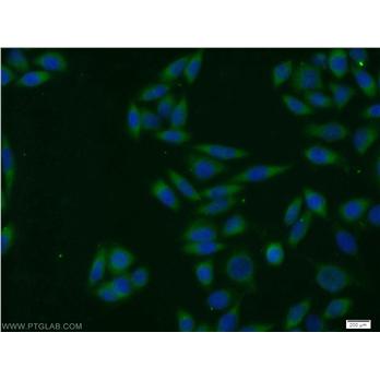 SNX3 Rabbit Polyclonal Antibody (10772-1-AP)