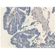 TESC Rabbit Polyclonal Antibody (11125-1-AP)