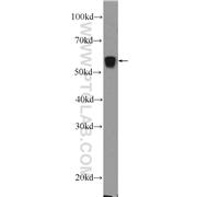 PCCB Rabbit Polyclonal Antibody (11139-1-AP)