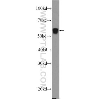 PCCB Rabbit Polyclonal Antibody (11139-1-AP)