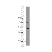 SLC27A4 Rabbit Polyclonal Antibody (11013-1-AP)