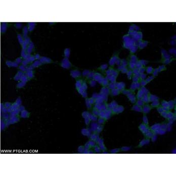 TGFB1I1 Rabbit Polyclonal Antibody (10565-1-AP)