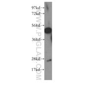 CNTFR Rabbit Polyclonal Antibody (10796-1-AP)