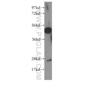 CNTFR Rabbit Polyclonal Antibody (10796-1-AP)
