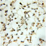 NR4A2 Rabbit Polyclonal Antibody (10975-2-AP)