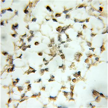 NR4A2 Rabbit Polyclonal Antibody (10975-2-AP)