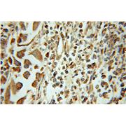 HMGN2 Rabbit Polyclonal Antibody (10953-1-AP)