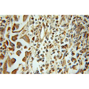 HMGN2 Rabbit Polyclonal Antibody (10953-1-AP)