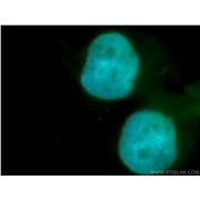SMARCD1 Rabbit Polyclonal Antibody (10998-2-AP)